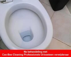 Urinesteen Pakket - Voor Het Verwijderen Van Urinesteen En Het Voorkomen Van Urinesteen - 1x Urinesteenoplosser - 2x Toiletreiniger -Schoonmaakmiddelen Winkel 1200x971